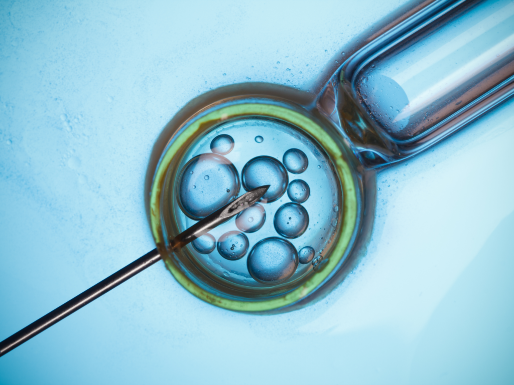 ivf