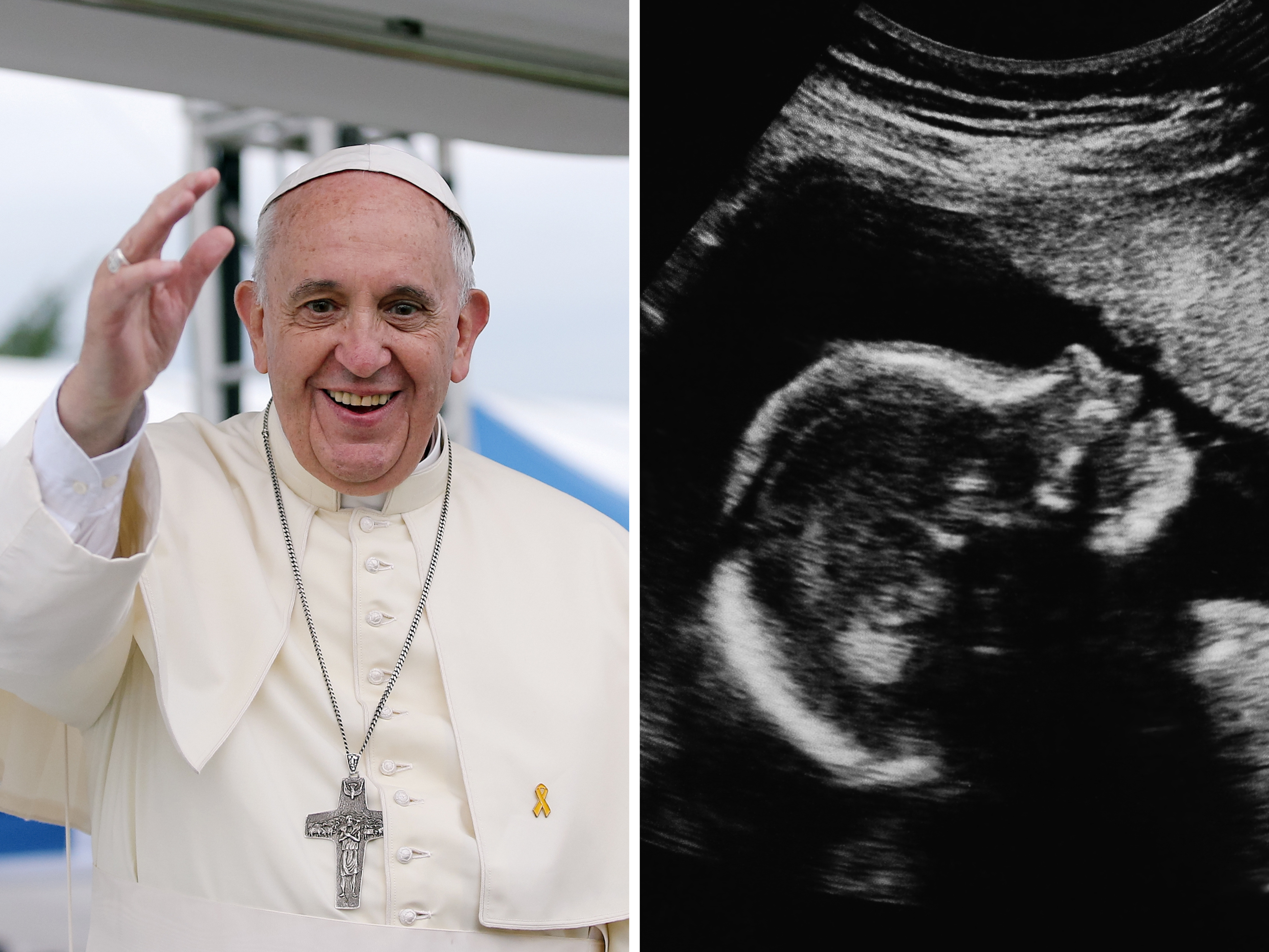 Pope Francis calls on all people to protect unborn babies and their mothers from abortion in message from hospital