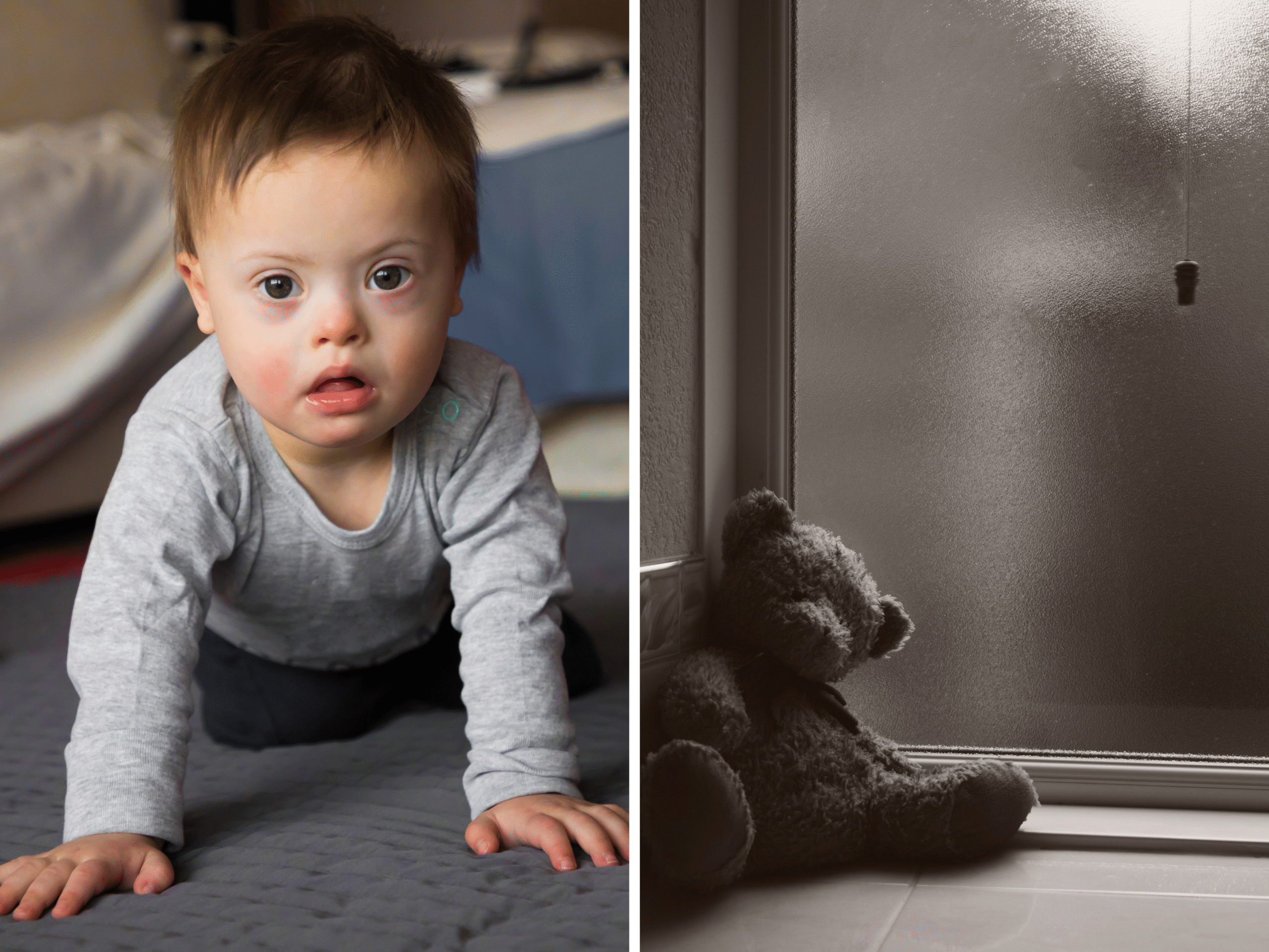 Abortions of unborn babies with Down’s syndrome surges 80 per cent in Scotland