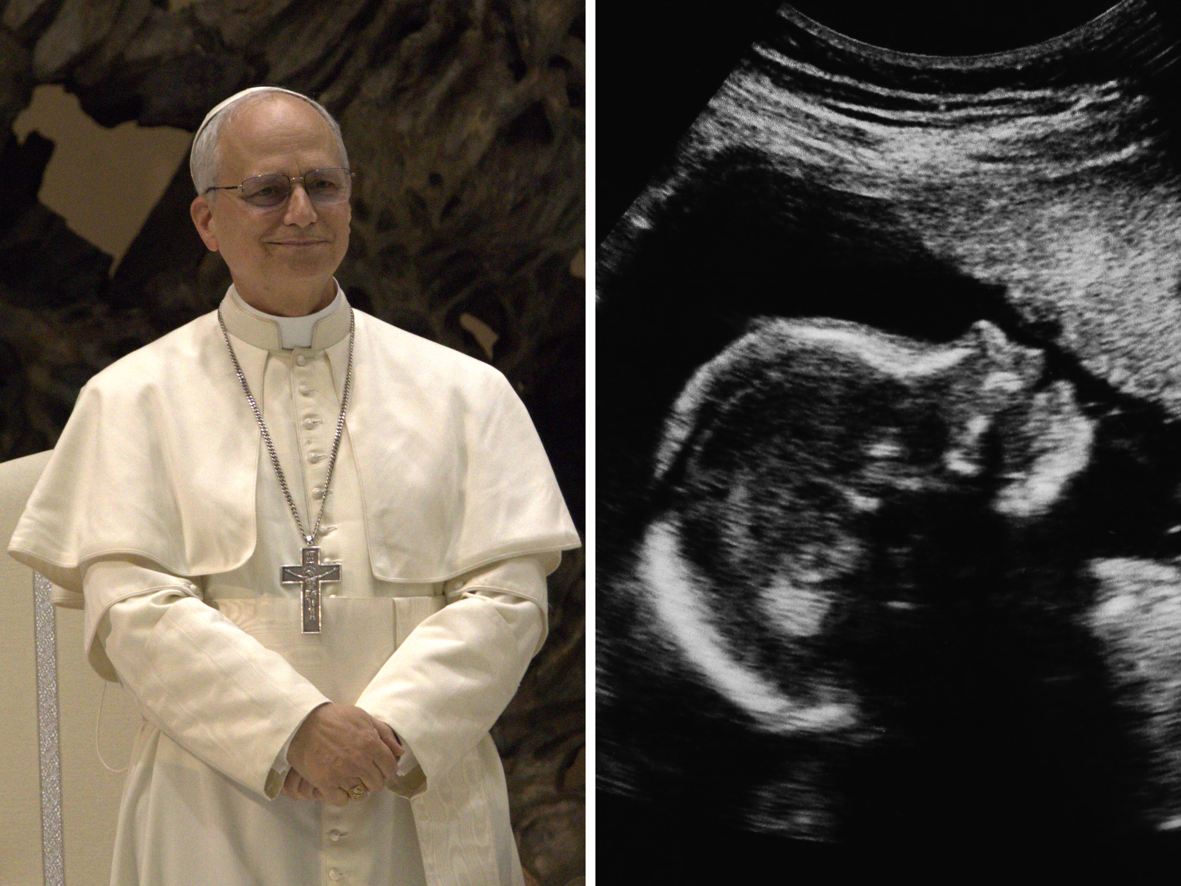 Pope Leo XIV reaffirms Catholic Church’s pro-life teaching to world ambassadors, calls on worldwide leaders to protect unborn babies